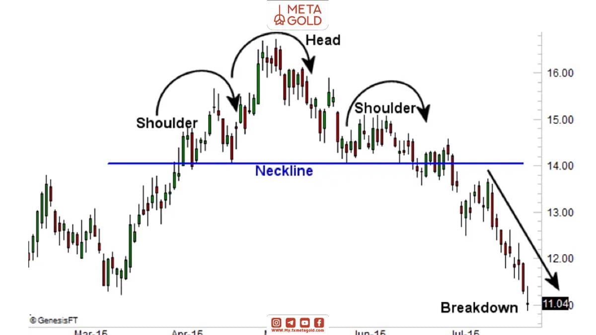 الگوی سر و شانه